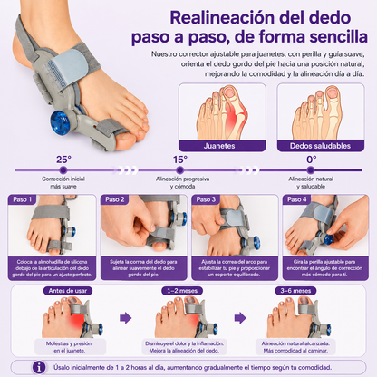 Corrector de Juanetes con Sistema de Doble Tensión